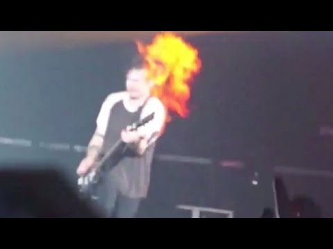 Wajah Michael Clifford Diperban usai Terbakar di Atas Panggung