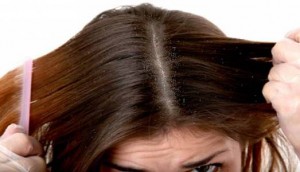 rambut berkutu