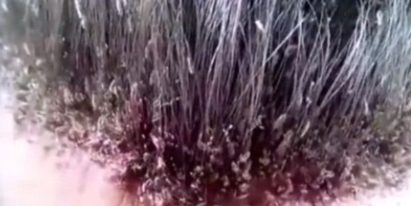 Jangan Tonton Video Ini, Jika Anda Tidak Ingin Merasa Gatal di Kepala!