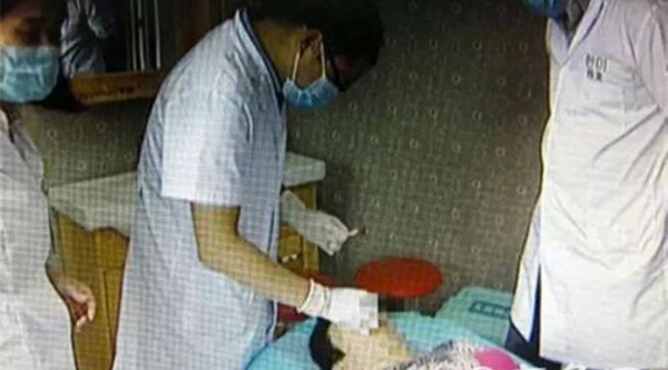 Telponnya Tak diangkat, Seorang Suami Tega Menggigit Hidung Istrinya! 2